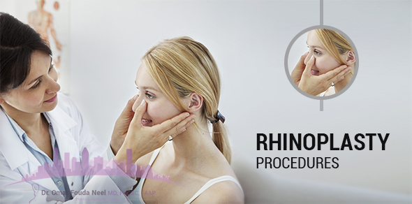 Rhinoplasty Procedures