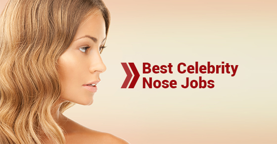 Best Celebrity Nose Jobs