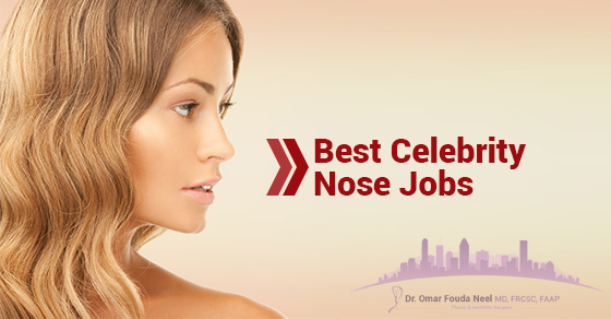 Best Celebrity Nose Jobs