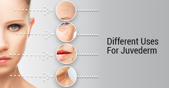 Different Uses For Juvederm