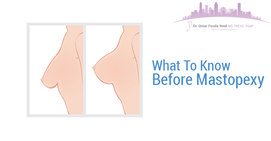 What To Know Before Mastopexy