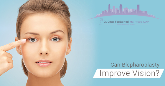 Blepharoplasty