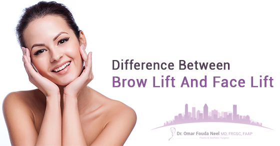 Brow Lift VS Face Lift