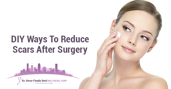 10 DIY Tips To Reduce Scars After Surgery - Dr. Omar Fouda Neel