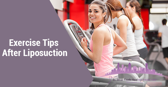 Exercise After Liposuction