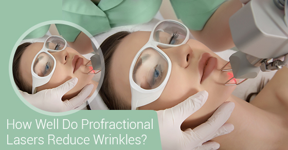 How Well Do Profractional Lasers Reduce Wrinkles?