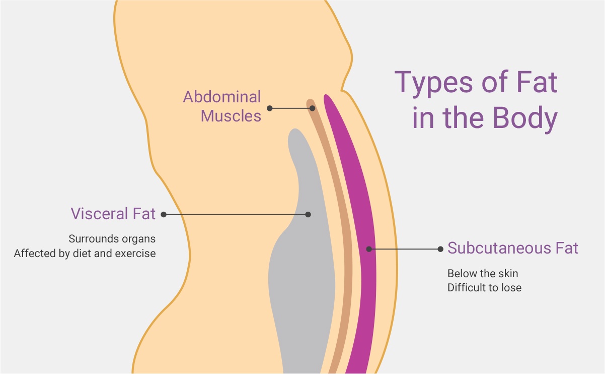 Liposuction incision options