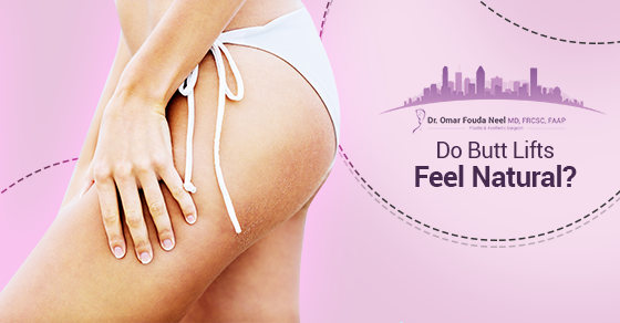 Do Butt Lifts Feel Natural? 1 Do Butt Lifts Feel Natural