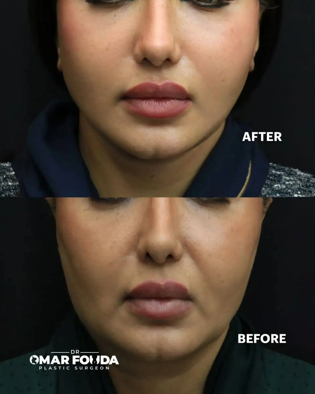 489801989_18509220928056398_504214243765936617_n