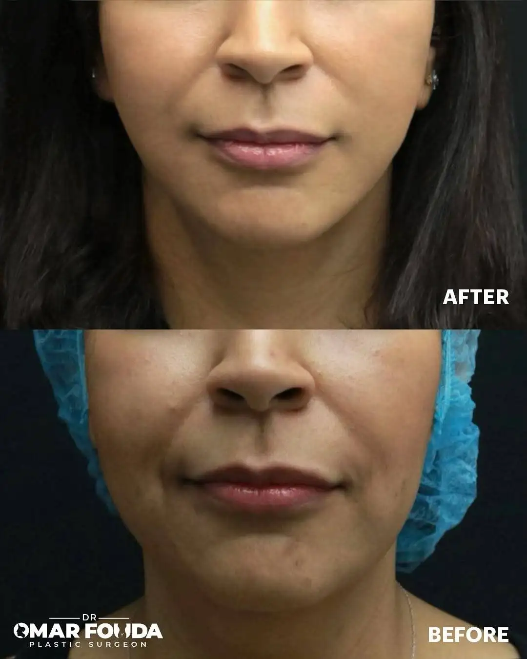 499875441_18516130243056398_5261975698696898614_n