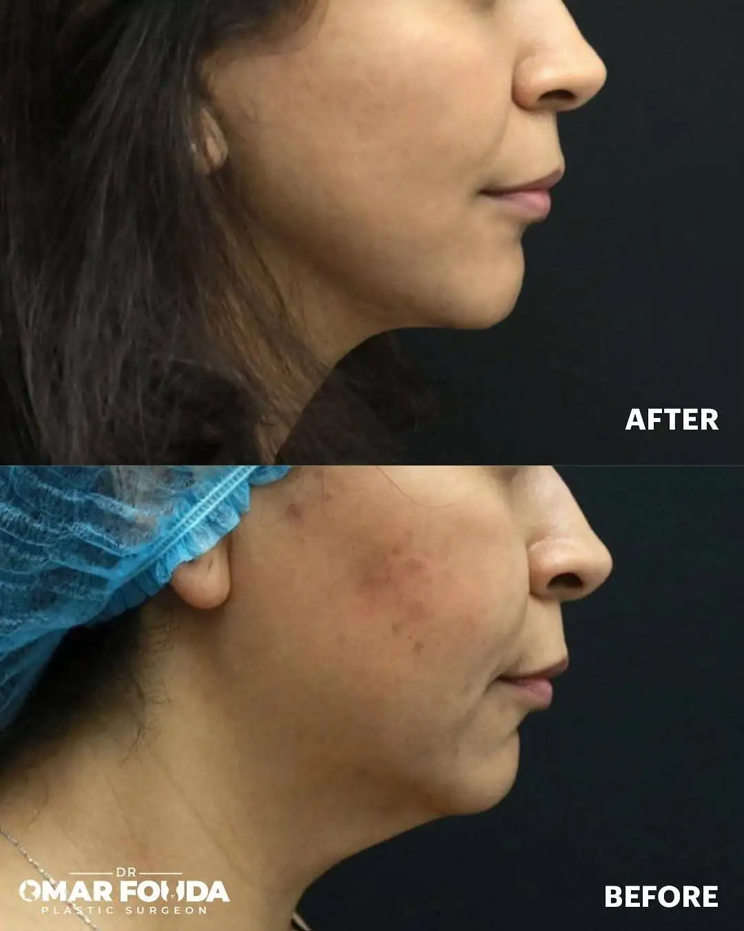 500122147_18516130252056398_4054387795943413872_n