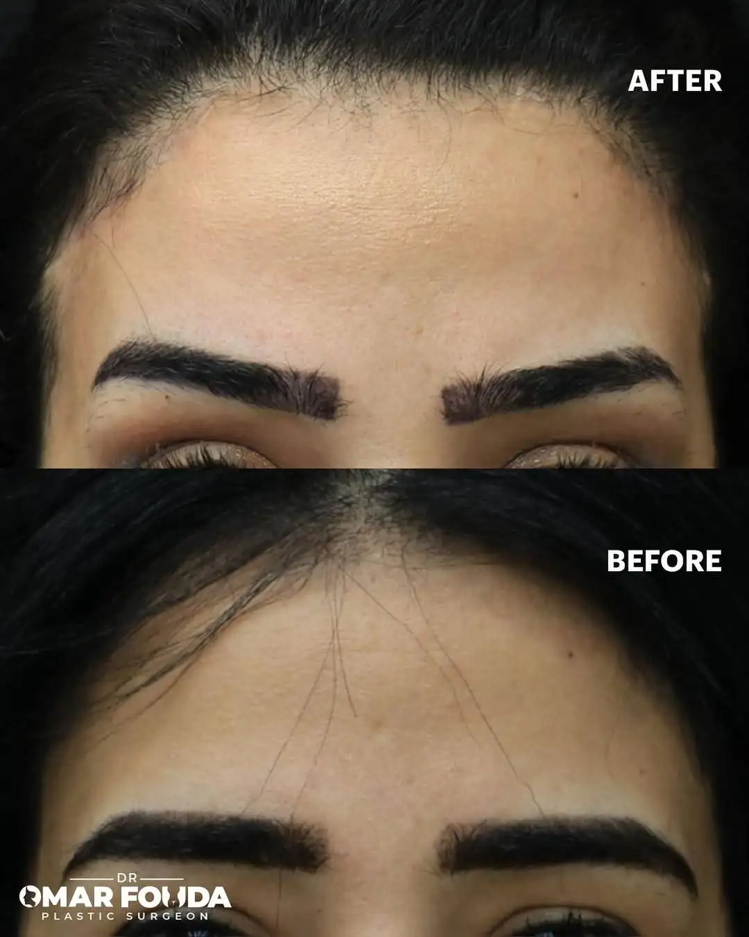 500982091_18517445644056398_5428580989584688780_n