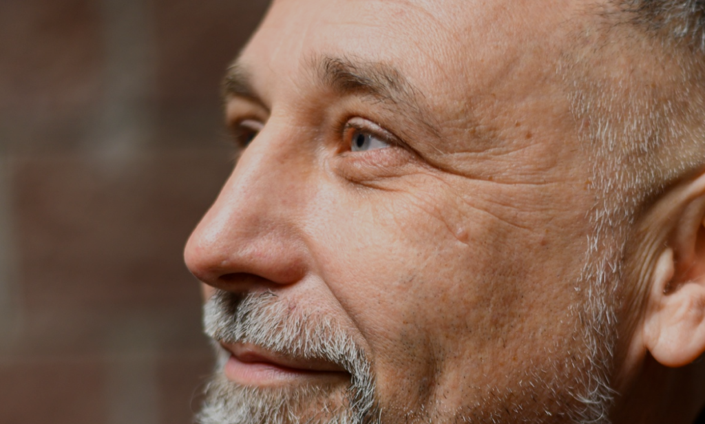 Blepharoplasty for men