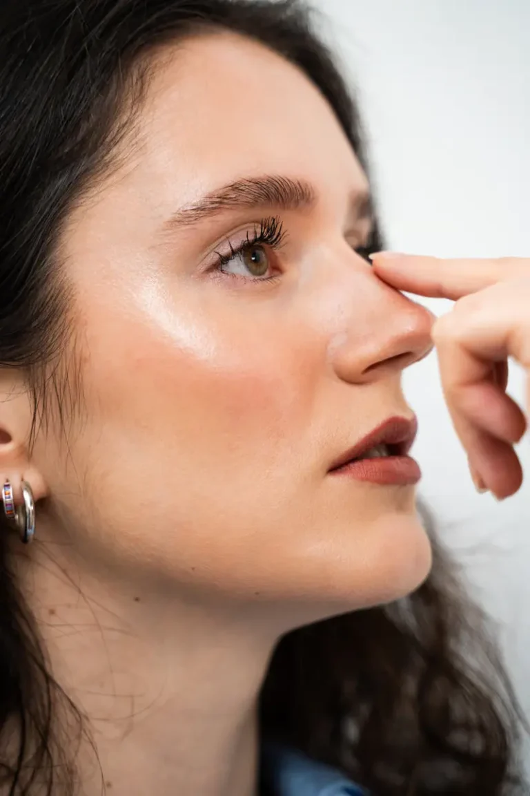 bulbous nose rhinoplasty before and after